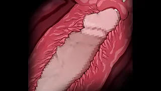 animation