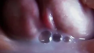 Natural insemination